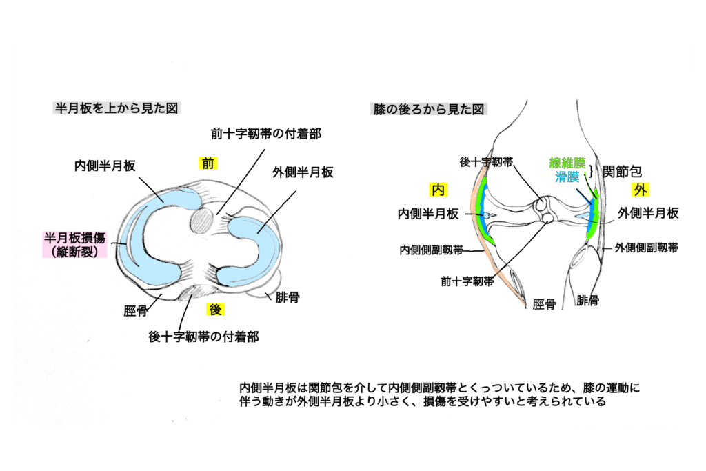 半月板損傷 整形外科診断ツール